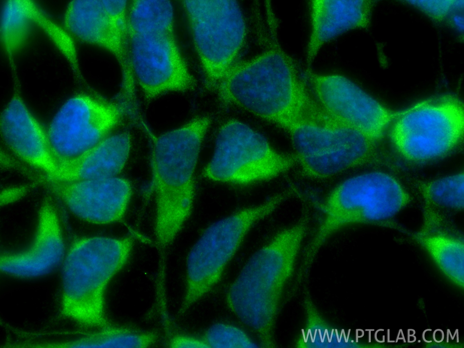 Immunofluorescent analysis of (-20°C Ethanol) fixed HEK-293 cells using TXNDC9 antibody (25208-1-AP) at dilution of 1:400 and CoraLite®488-Conjugated Goat Anti-Rabbit IgG(H+L) (SA00013-2). Immunofluorescence (IF) / fluorescent staining of HEK-293 cells using TXNDC9 Polyclonal antibody (25208-1-AP)