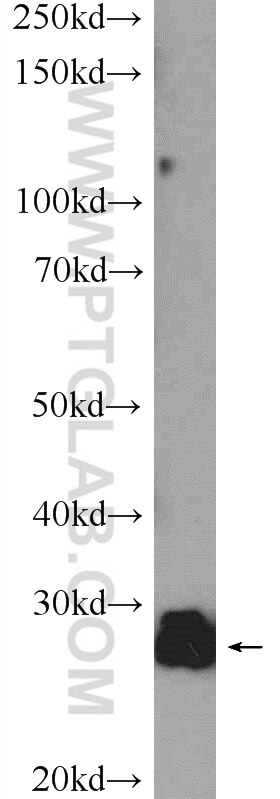 WB analysis of HEK-293 using 25208-1-AP