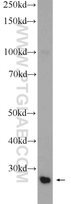 Western Blot (WB) analysis of K-562 cells using TXNDC9 Polyclonal antibody (25208-1-AP)