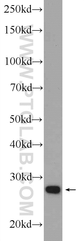 Western Blot (WB) analysis of Raji cells using TXNDC9 Polyclonal antibody (25208-1-AP)