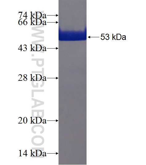 TXNDC9 fusion protein Ag19509 SDS-PAGE