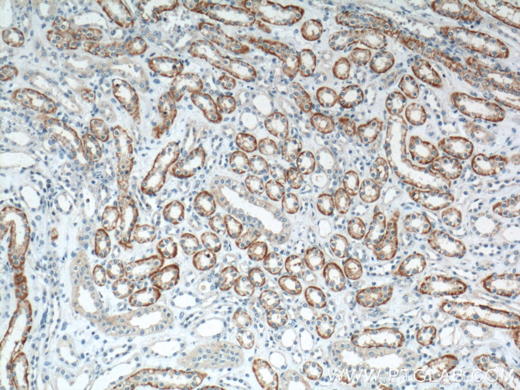 Immunohistochemistry (IHC) staining of human kidney tissue using TXNIP Polyclonal antibody (18243-1-AP)