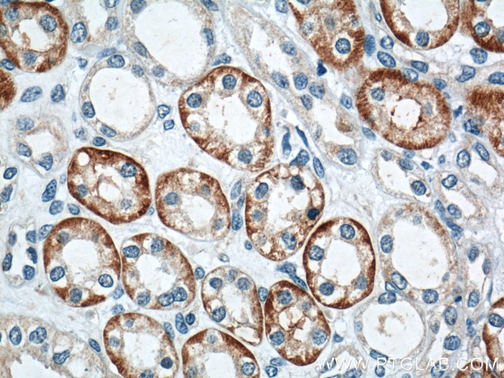 Immunohistochemistry (IHC) staining of human kidney tissue using TXNIP Polyclonal antibody (18243-1-AP)