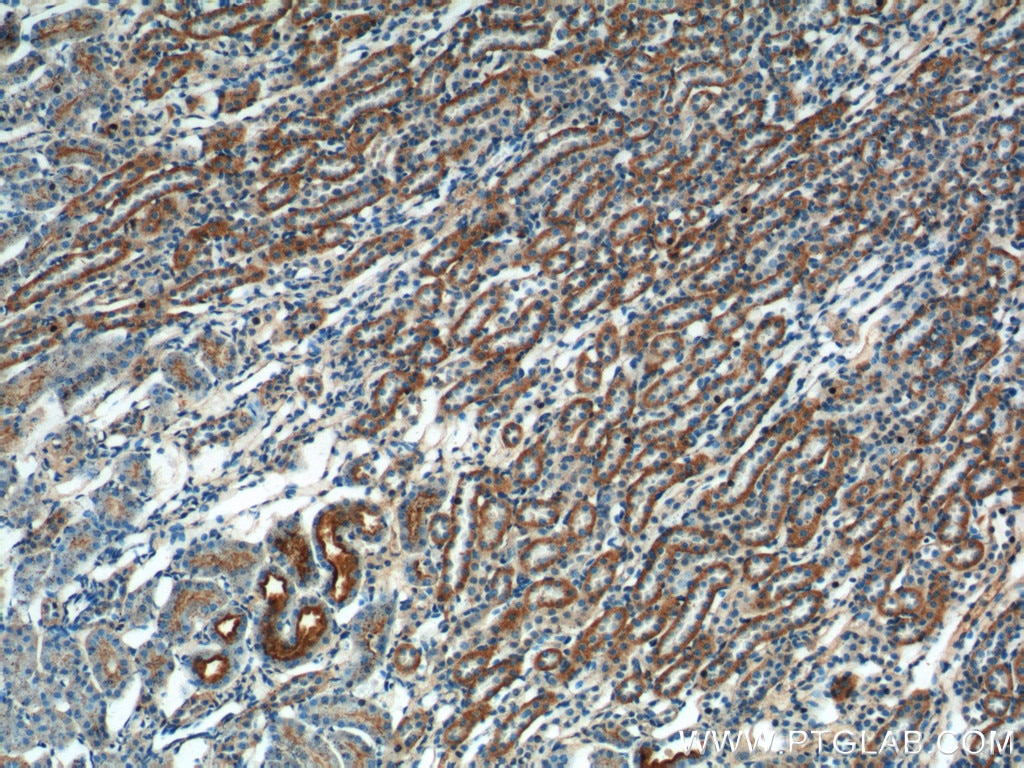 Immunohistochemistry (IHC) staining of mouse kidney tissue using TXNIP Polyclonal antibody (18243-1-AP)