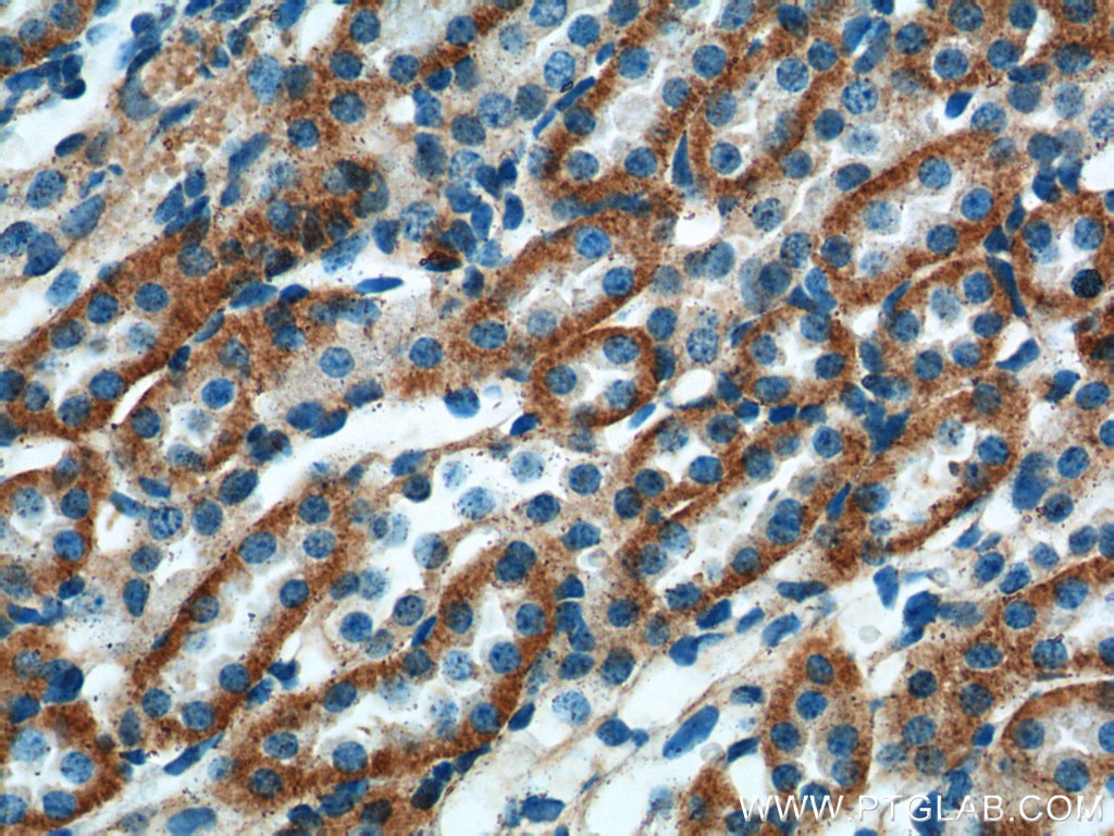 Immunohistochemistry (IHC) staining of mouse kidney tissue using TXNIP Polyclonal antibody (18243-1-AP)