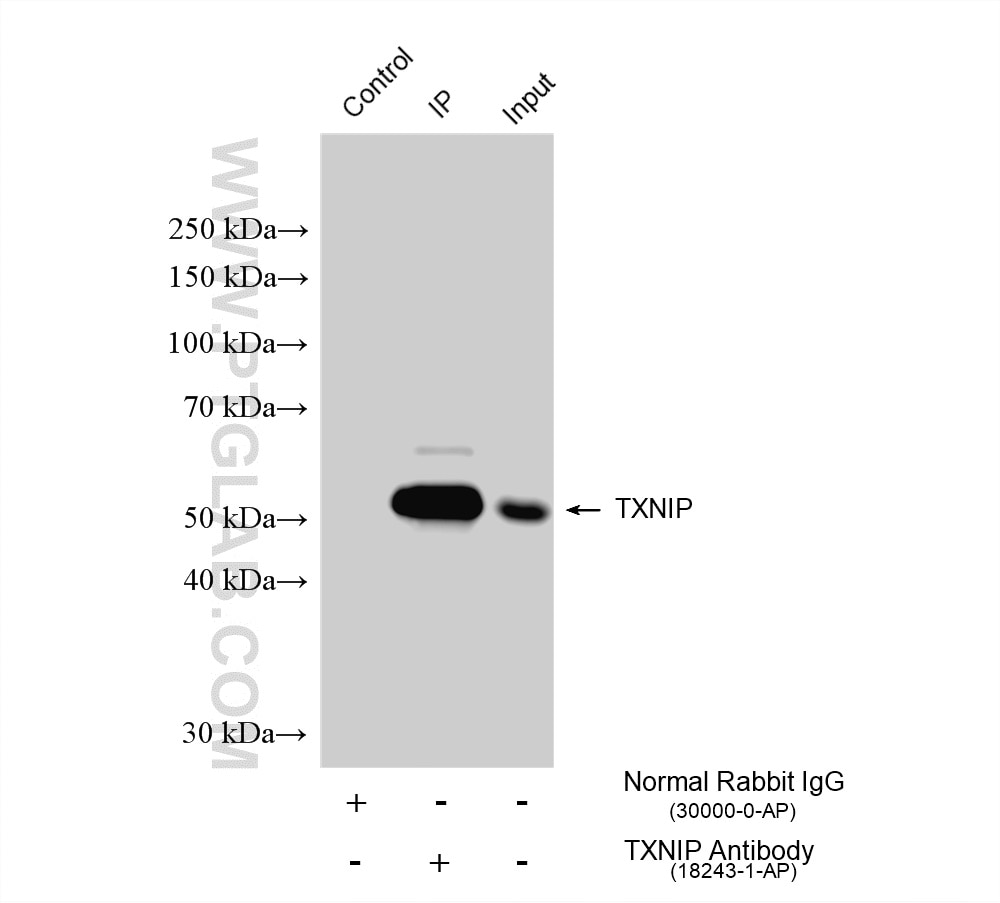 IP experiment of BxPC-3 using 18243-1-AP Immunoprecipitation (IP) experiment of BxPC-3 cells using TXNIP Polyclonal antibody (18243-1-AP)