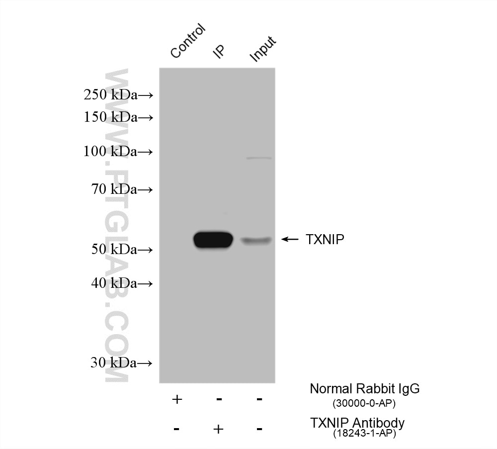 IP experiment of HL-60 using 18243-1-AP Immunoprecipitation (IP) experiment of HL-60 cells using TXNIP Polyclonal antibody (18243-1-AP)