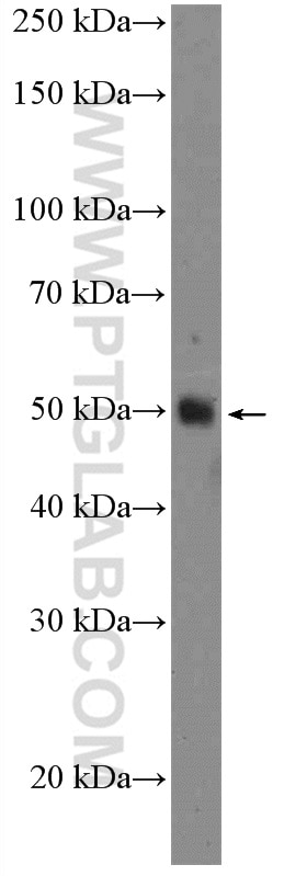 Western Blot (WB) analysis of HL-60 cells using TXNIP Polyclonal antibody (18243-1-AP)