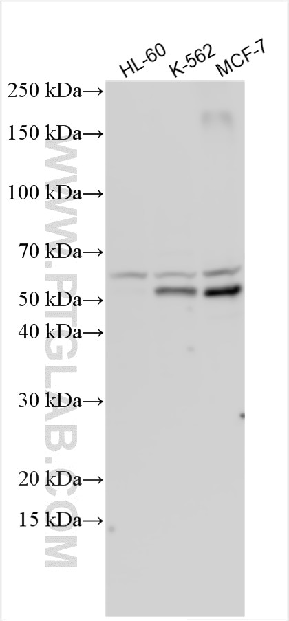 Western Blot (WB) analysis of various lysates using TXNIP Polyclonal antibody (18243-1-AP)