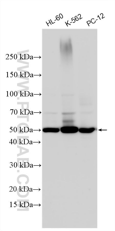 Western Blot (WB) analysis of various lysates using TXNIP Polyclonal antibody (18243-1-AP)