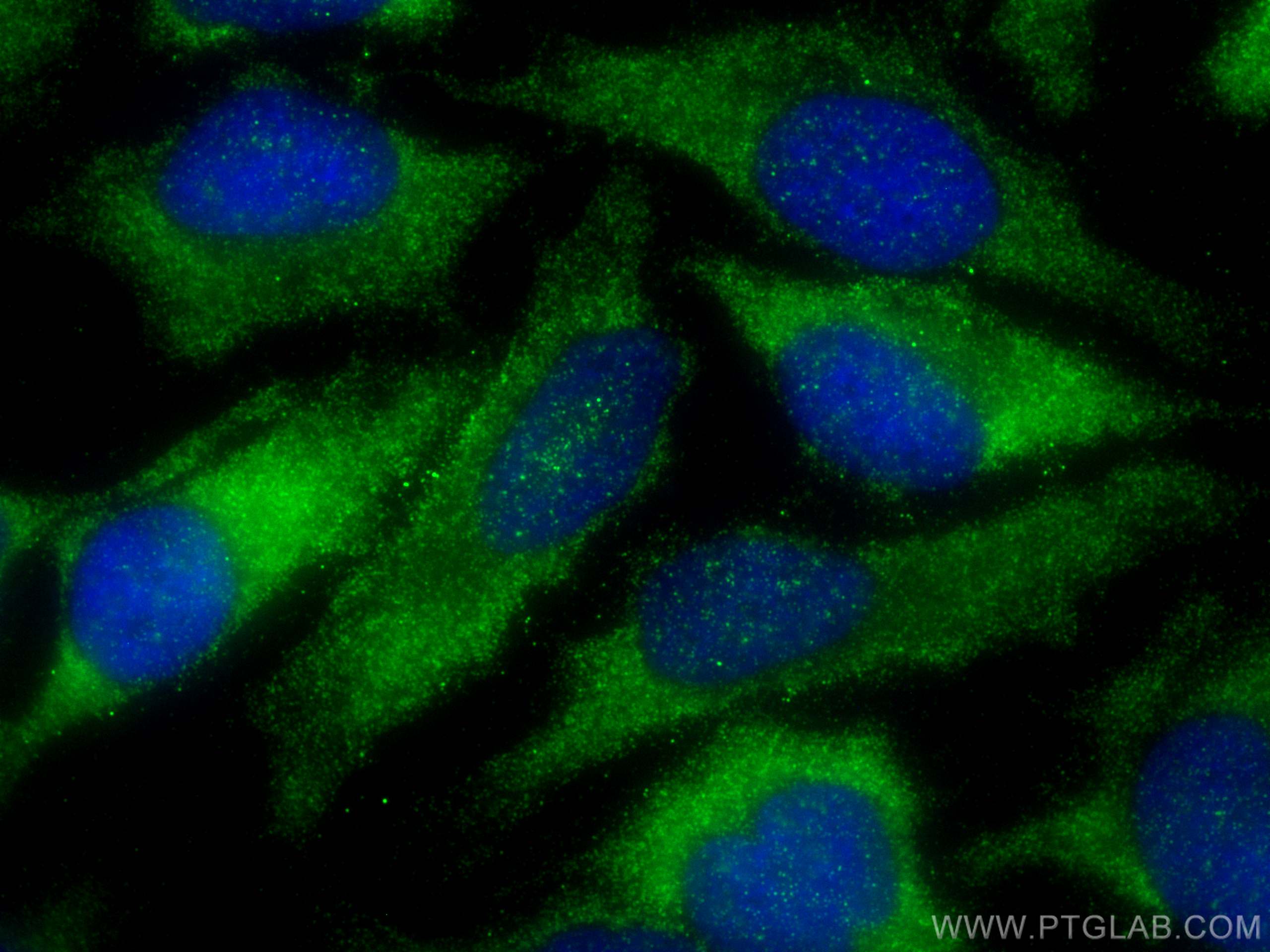 Immunofluorescence (IF) / fluorescent staining of HeLa cells using TXNIP Polyclonal antibody (27429-1-AP)