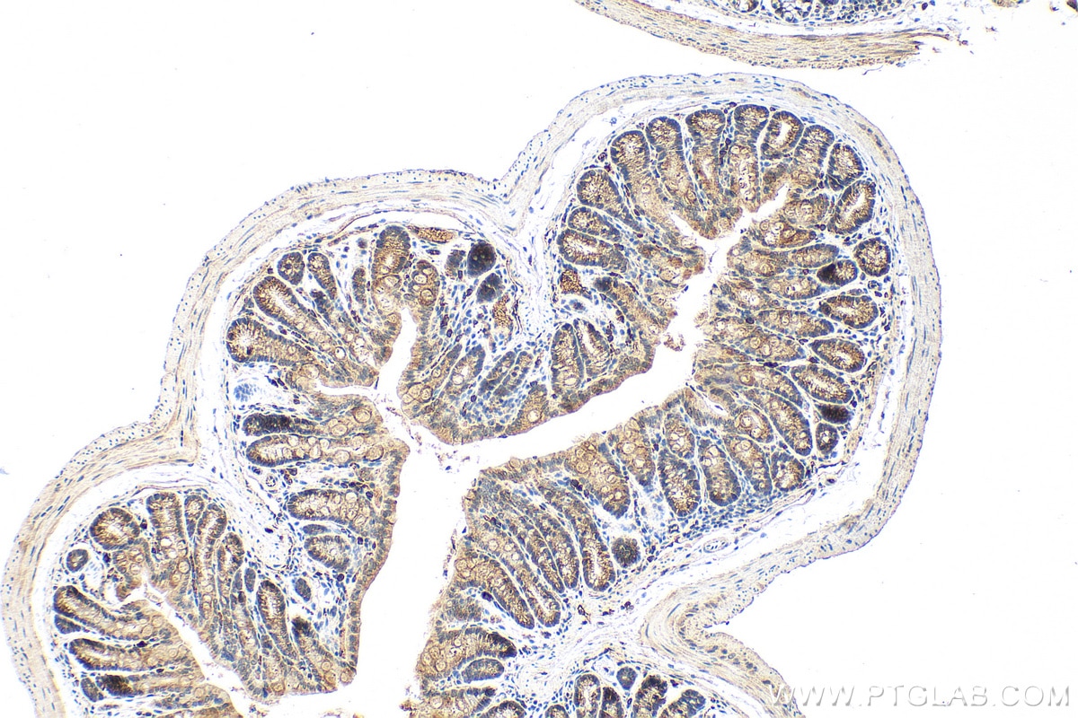Immunohistochemistry (IHC) staining of mouse colon tissue using TXNIP Polyclonal antibody (27429-1-AP)