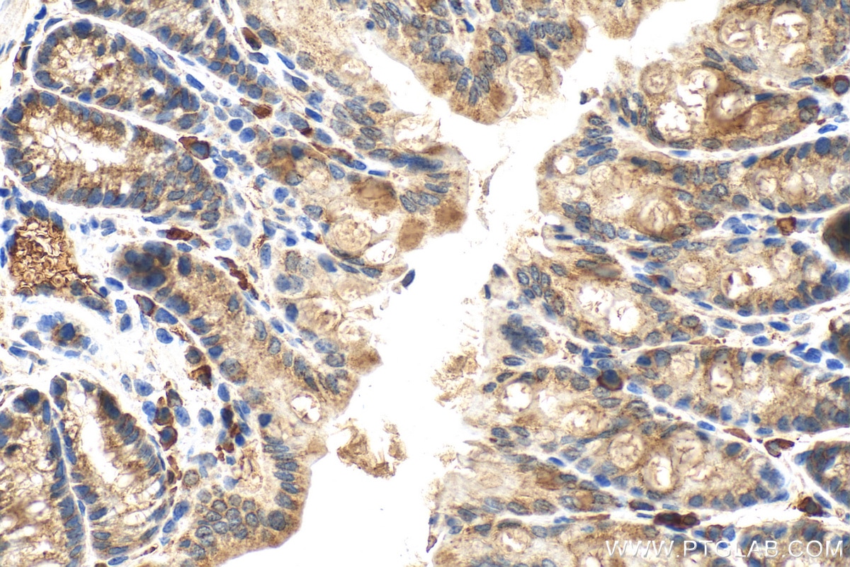 Immunohistochemistry (IHC) staining of mouse colon tissue using TXNIP Polyclonal antibody (27429-1-AP)