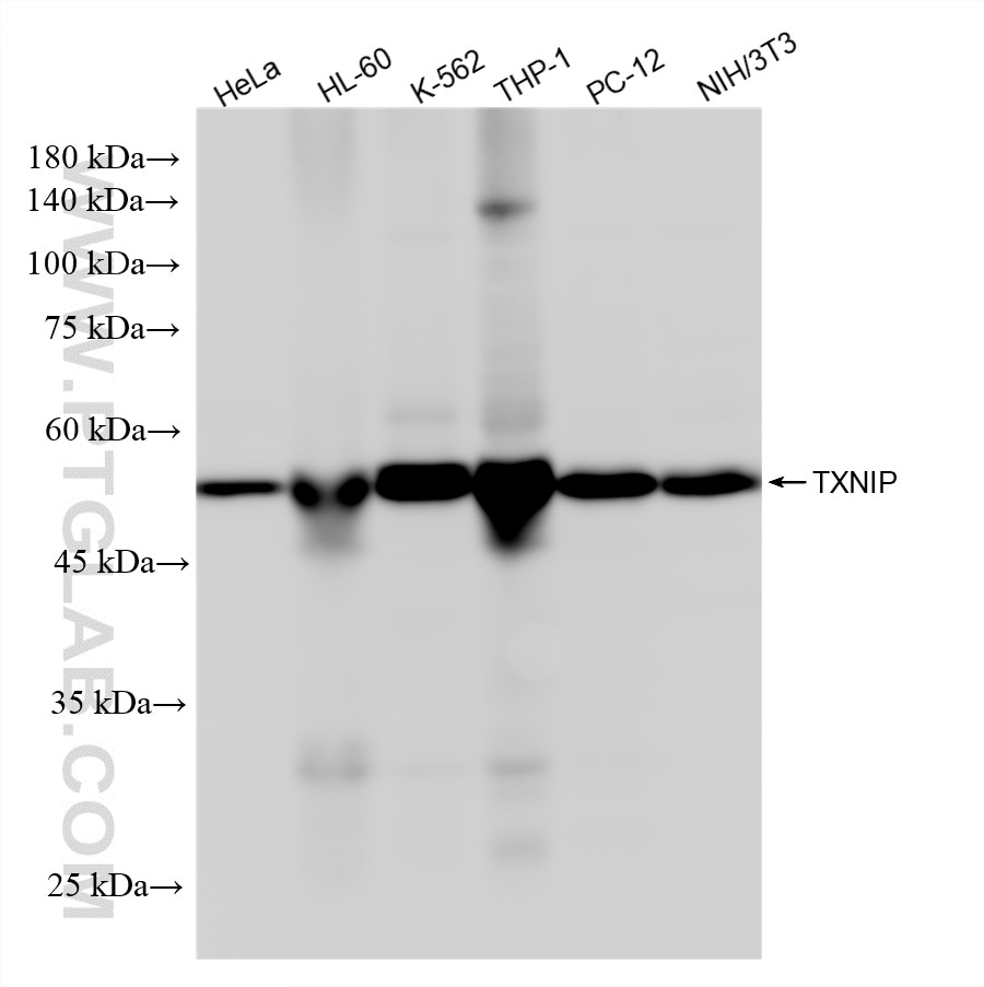 WB analysis using 87483-1-RR Western Blot (WB) analysis of various lysates using TXNIP Recombinant monoclonal antibody (87483-1-RR)