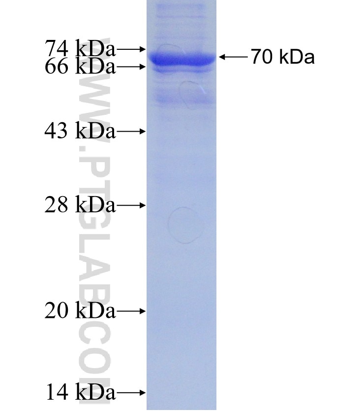 TXNIP fusion protein Ag13009 SDS-PAGE