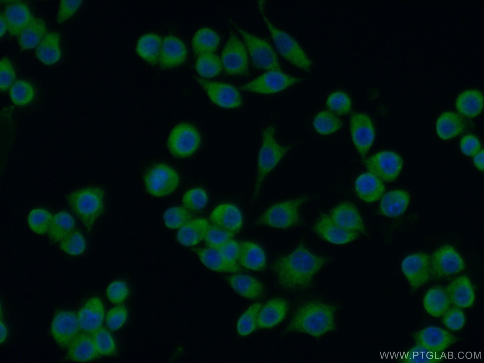 Immunofluorescence (IF) / fluorescent staining of RAW 264.7 cells using TXNL1 Polyclonal antibody (15289-1-AP)