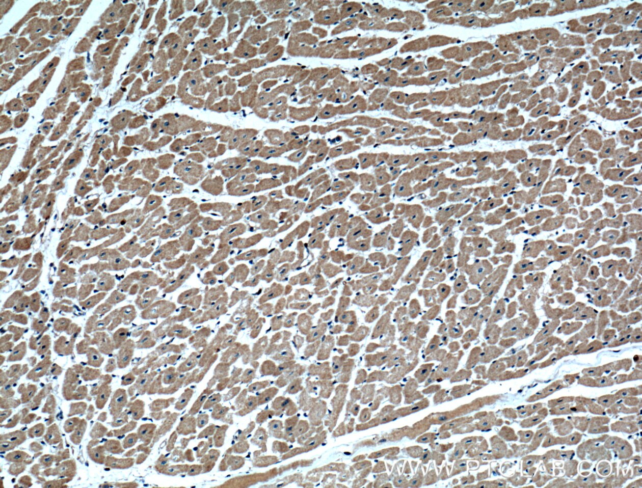 Immunohistochemistry (IHC) staining of human heart tissue using TXNL1 Polyclonal antibody (15289-1-AP)