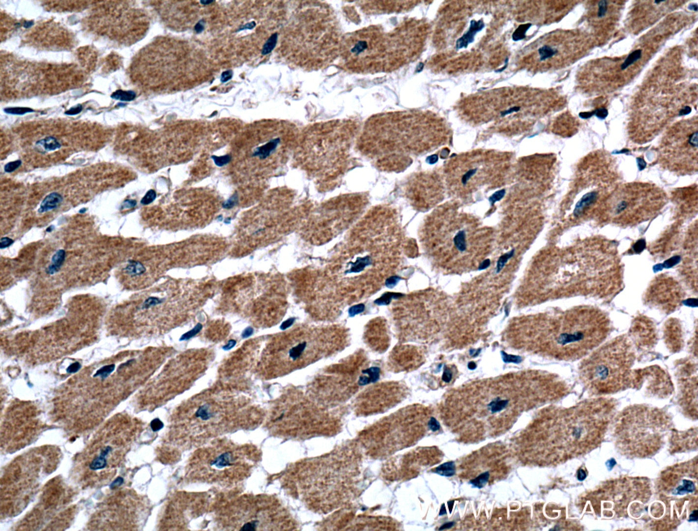 Immunohistochemistry (IHC) staining of human heart tissue using TXNL1 Polyclonal antibody (15289-1-AP)