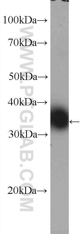 WB analysis of HL-60 using 15289-1-AP