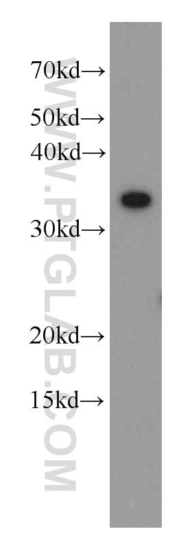 Western Blot (WB) analysis of K-562 cells using TXNL1 Polyclonal antibody (15289-1-AP)