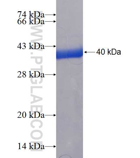 TXNL1 fusion protein Ag7481 SDS-PAGE