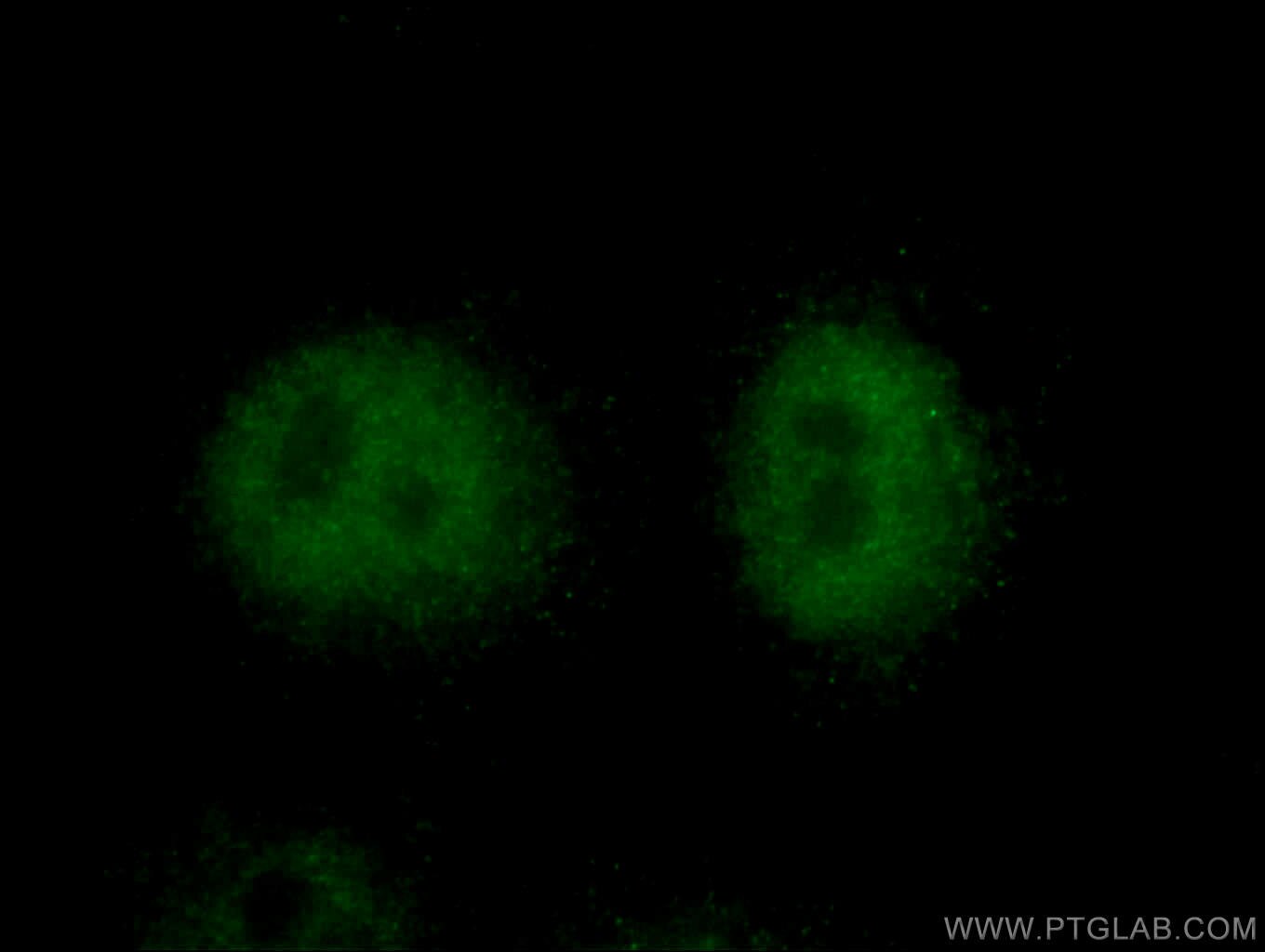 IF Staining of HepG2 using 27646-1-AP