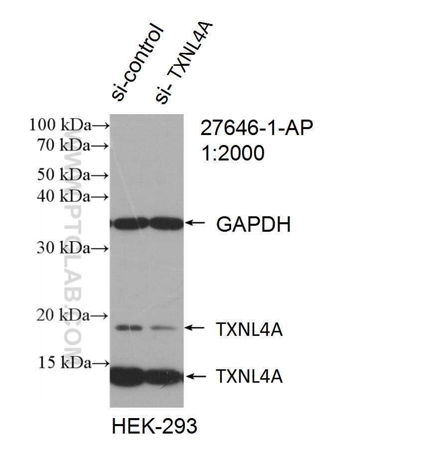 Western Blot (WB) analysis of HEK-293 cells using TXNL4A Polyclonal antibody (27646-1-AP)