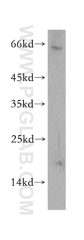 Western Blot (WB) analysis of HEK-293 cells using TXNL4B Polyclonal antibody (12927-1-AP)