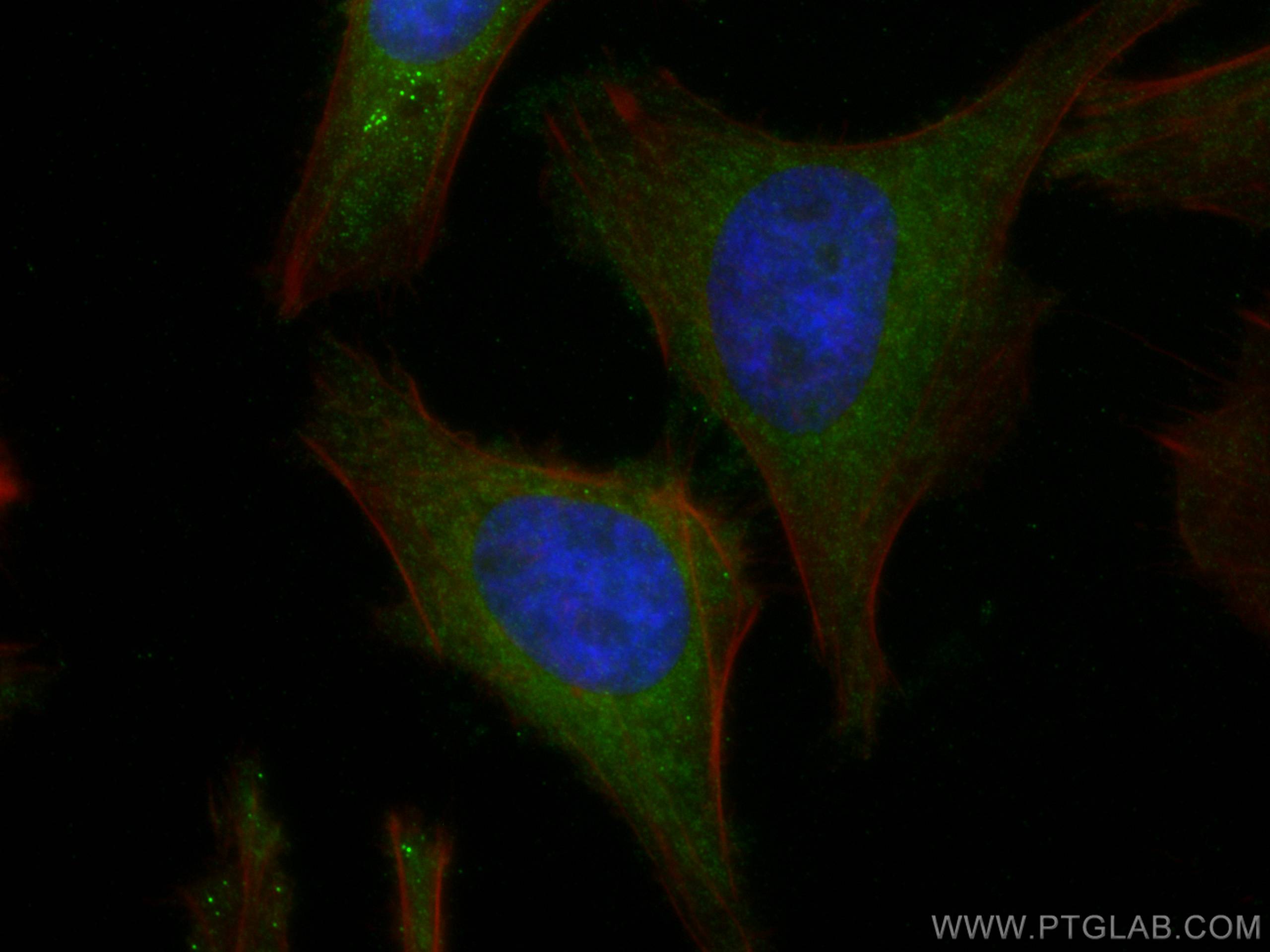 Immunofluorescence (IF) / fluorescent staining of HeLa cells using TXNRD1 Polyclonal antibody (11117-1-AP)