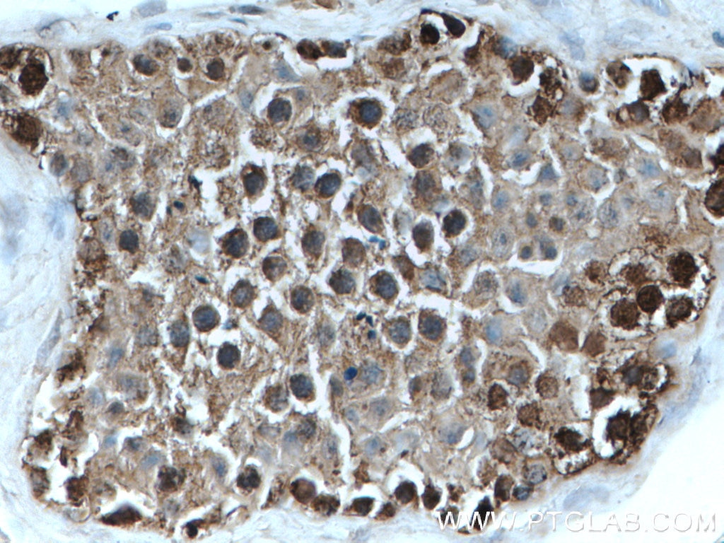 Immunohistochemistry (IHC) staining of human testis tissue using TXNRD1 Polyclonal antibody (11117-1-AP)