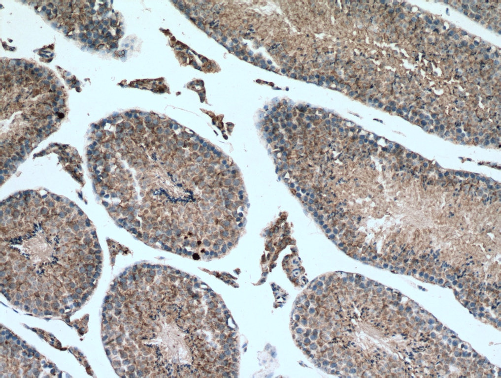 Immunohistochemistry (IHC) staining of mouse testis tissue using TXNRD1 Polyclonal antibody (11117-1-AP)
