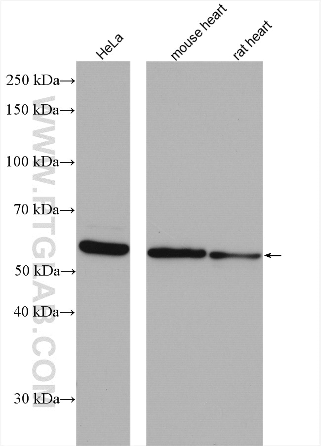Western Blot (WB) analysis of various lysates using TXNRD1 Polyclonal antibody (11117-1-AP)