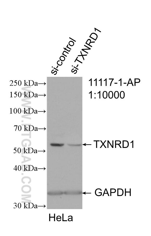 Western Blot (WB) analysis of HeLa cells using TXNRD1 Polyclonal antibody (11117-1-AP)