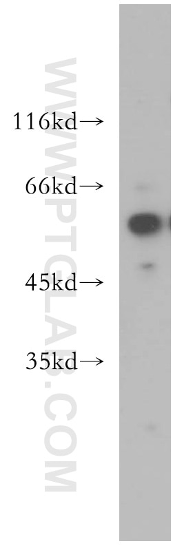 Western Blot (WB) analysis of MCF-7 cells using TXNRD1 Polyclonal antibody (11117-1-AP)