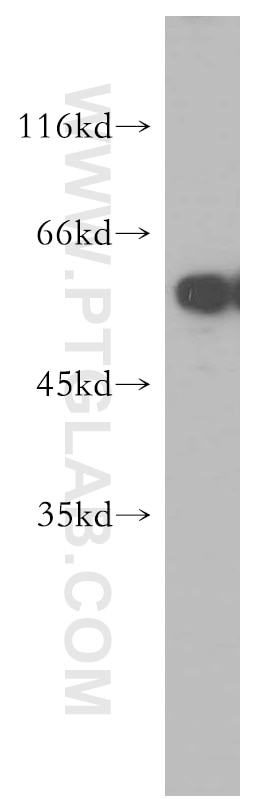 Western Blot (WB) analysis of Jurkat cells using TXNRD1 Polyclonal antibody (11117-1-AP)