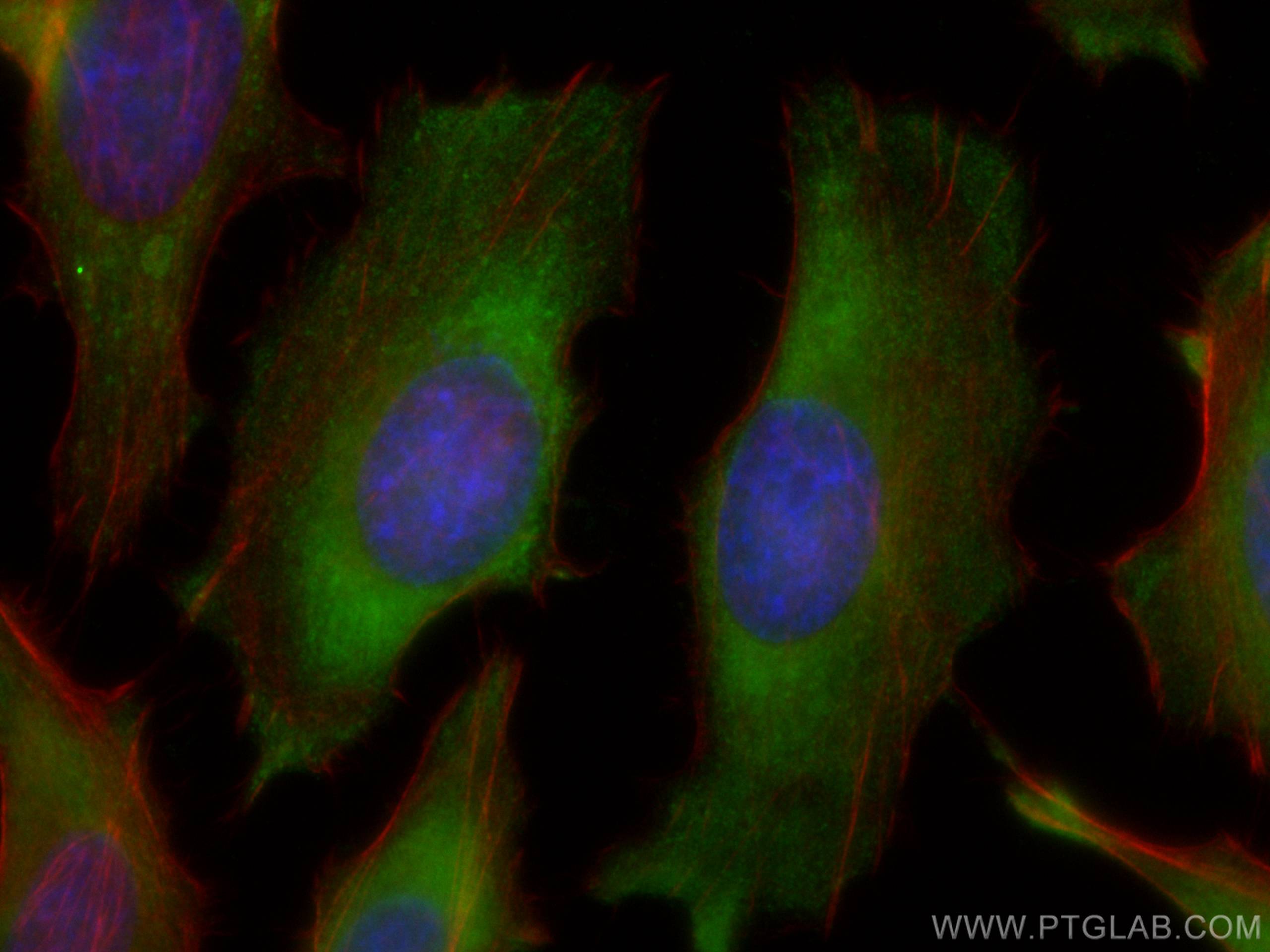 Immunofluorescence (IF) / fluorescent staining of HeLa cells using TXNRD1 Monoclonal antibody (67728-1-Ig)