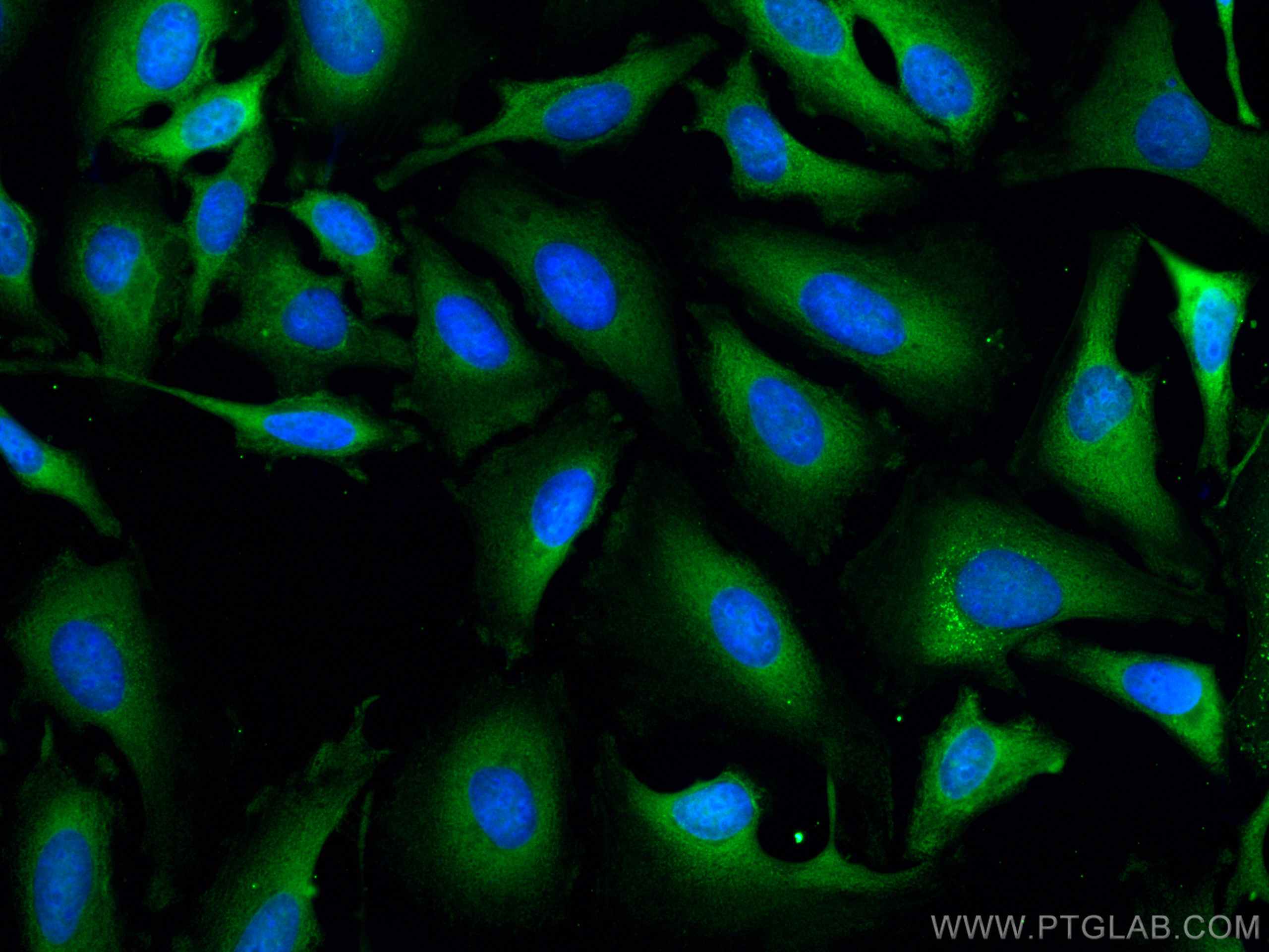 Immunofluorescence (IF) / fluorescent staining of HeLa cells using CoraLite® Plus 488-conjugated TXNRD1 Monoclonal an (CL488-67728)