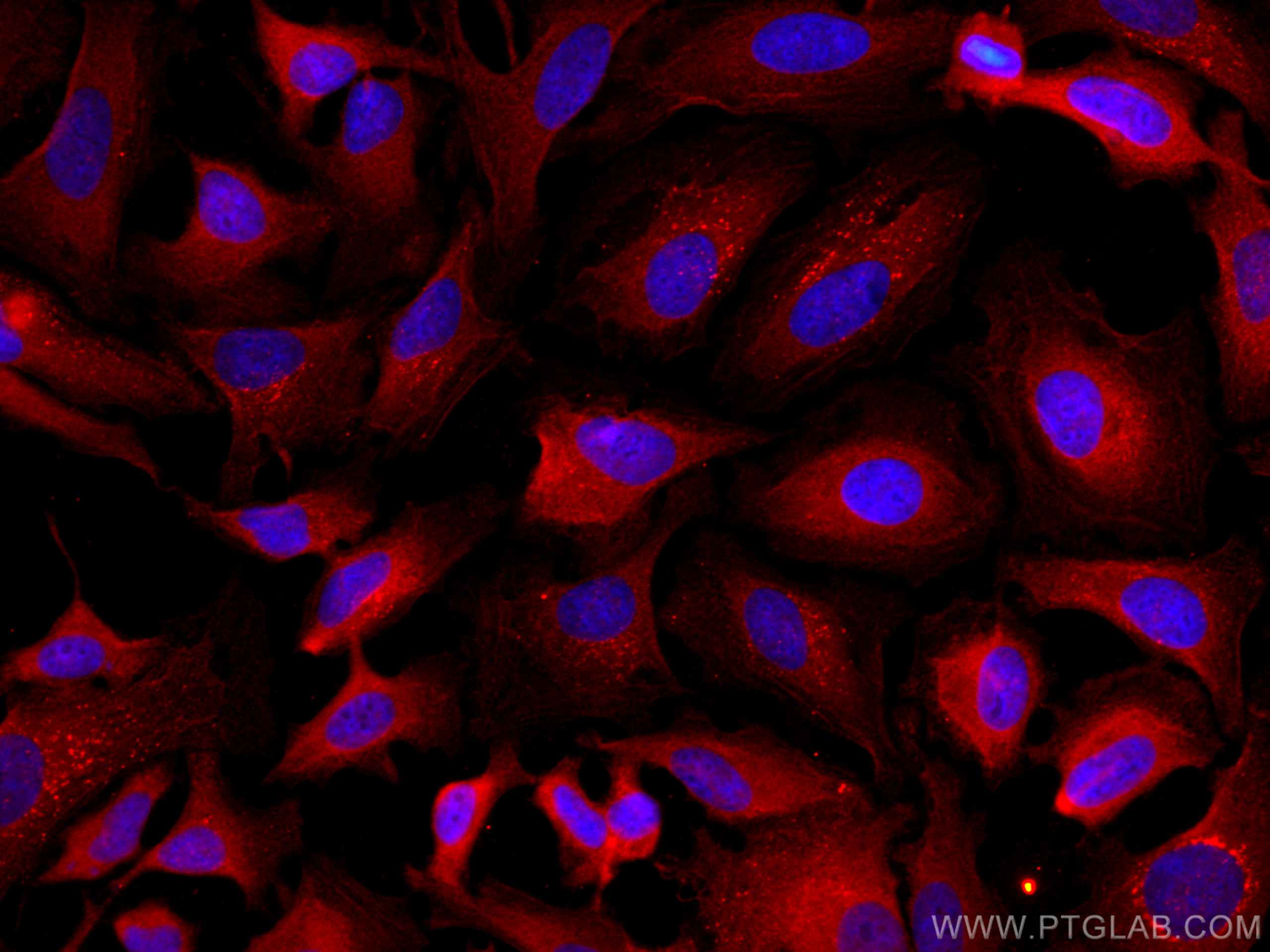 Immunofluorescence (IF) / fluorescent staining of HeLa cells using CoraLite®594-conjugated TXNRD1 Monoclonal antibody (CL594-67728)