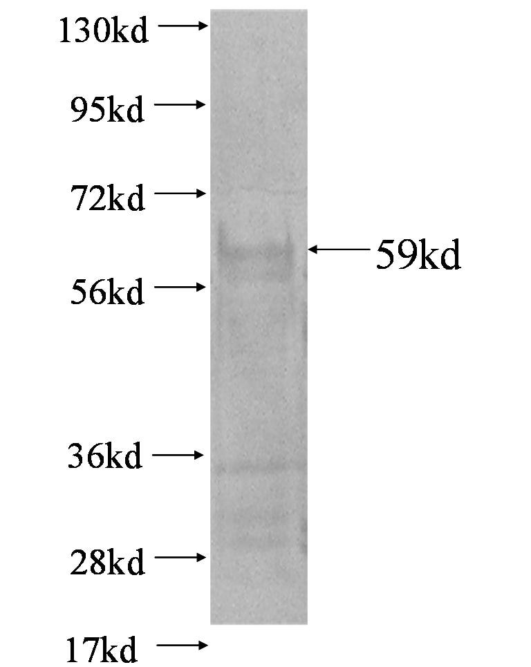 TXNRD1 fusion protein Ag1618 SDS-PAGE