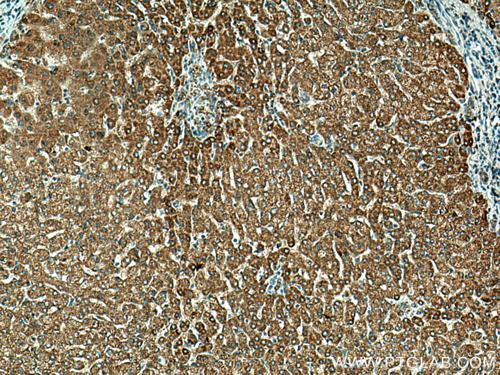 IHC staining of human liver using 16360-1-AP