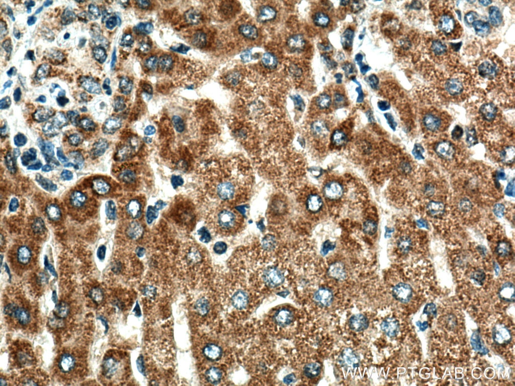 Immunohistochemistry (IHC) staining of human liver tissue using TXNRD2 Polyclonal antibody (16360-1-AP)