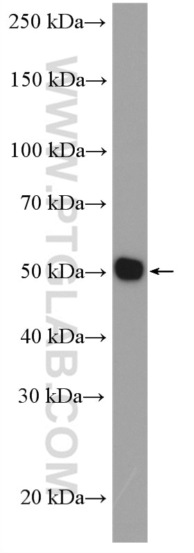 Western Blot (WB) analysis of MCF-7 cells using TXNRD2 Polyclonal antibody (16360-1-AP)
