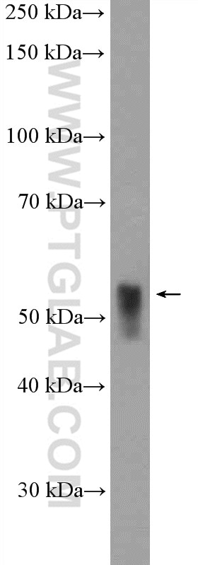 Western Blot (WB) analysis of rat liver tissue using TXNRD2 Polyclonal antibody (16360-1-AP)