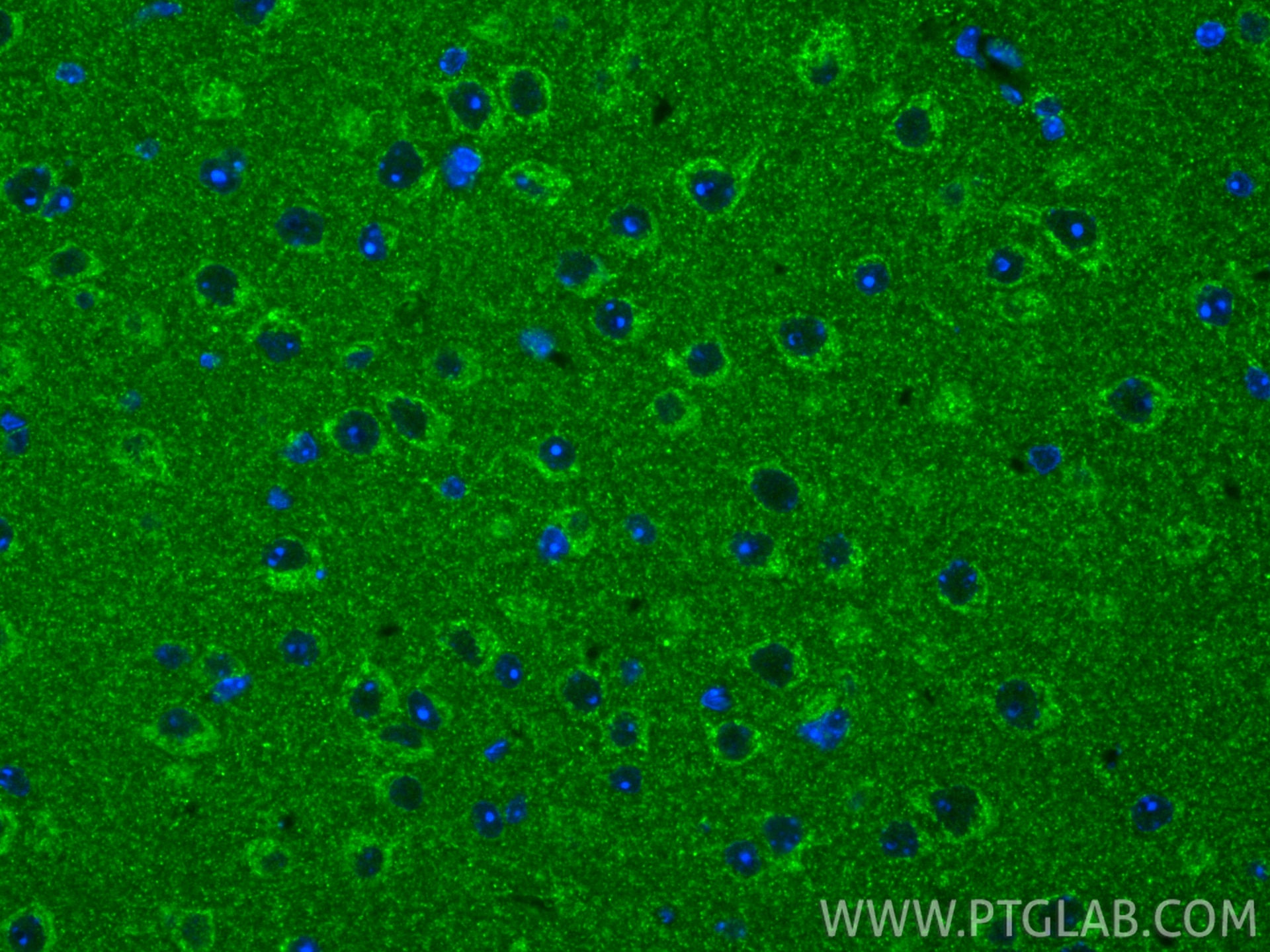 Immunofluorescence (IF) / fluorescent staining of mouse brain tissue using TXNRD2 Recombinant monoclonal antibody (85424-1-RR)