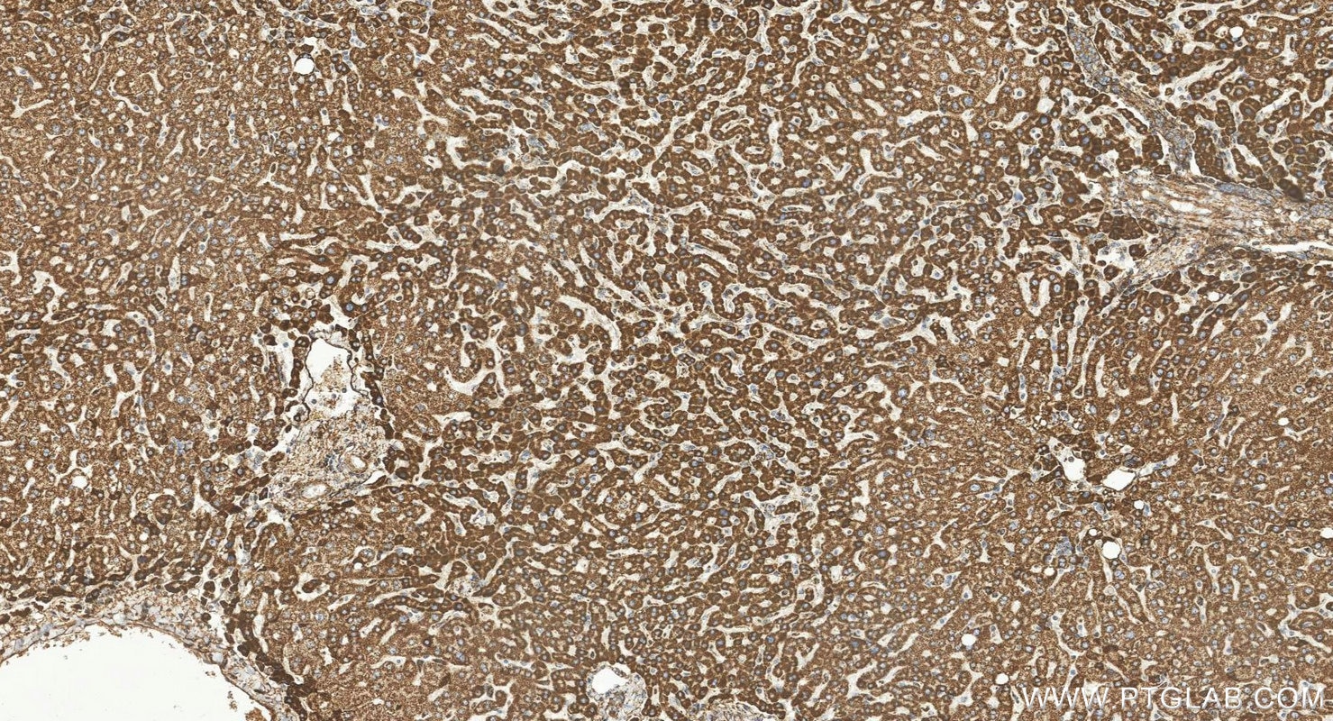 IHC staining of human liver using 85424-1-RR Immunohistochemistry (IHC) staining of human liver tissue using TXNRD2 Recombinant monoclonal antibody (85424-1-RR)