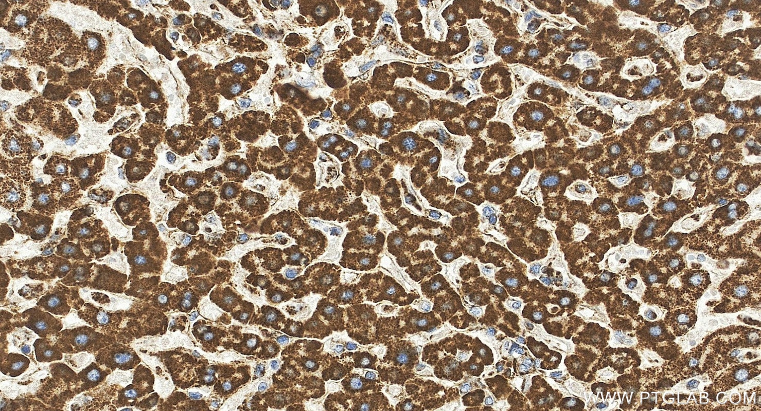 IHC staining of human liver using 85424-1-RR Immunohistochemistry (IHC) staining of human liver tissue using TXNRD2 Recombinant monoclonal antibody (85424-1-RR)