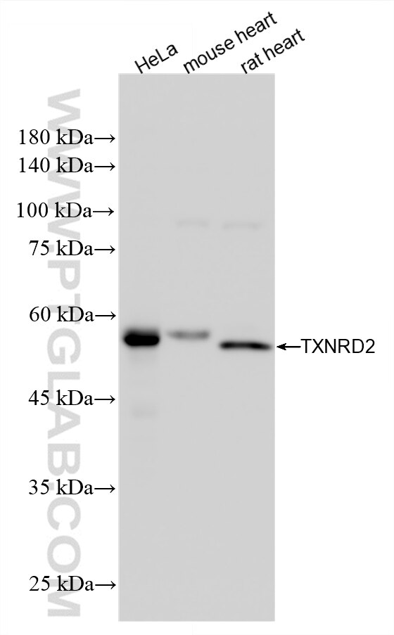 Western Blot (WB) analysis of various lysates using TXNRD2 Recombinant monoclonal antibody (85424-1-RR)