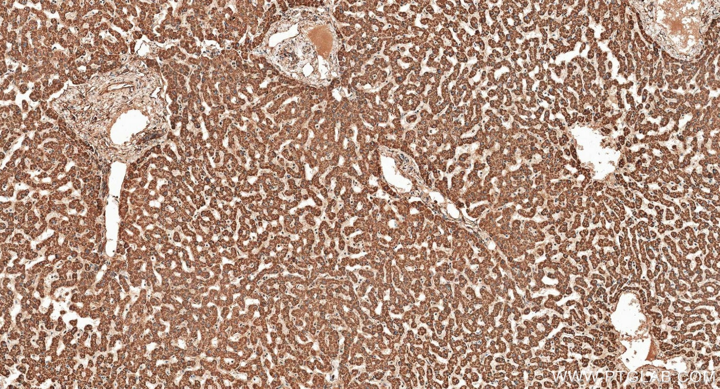 IHC staining of human liver using RMX00099 Immunohistochemistry (IHC) staining of human liver tissue using Multi-rAb® TXNRD2 Multi-Recombinant antibody (RMX00099)