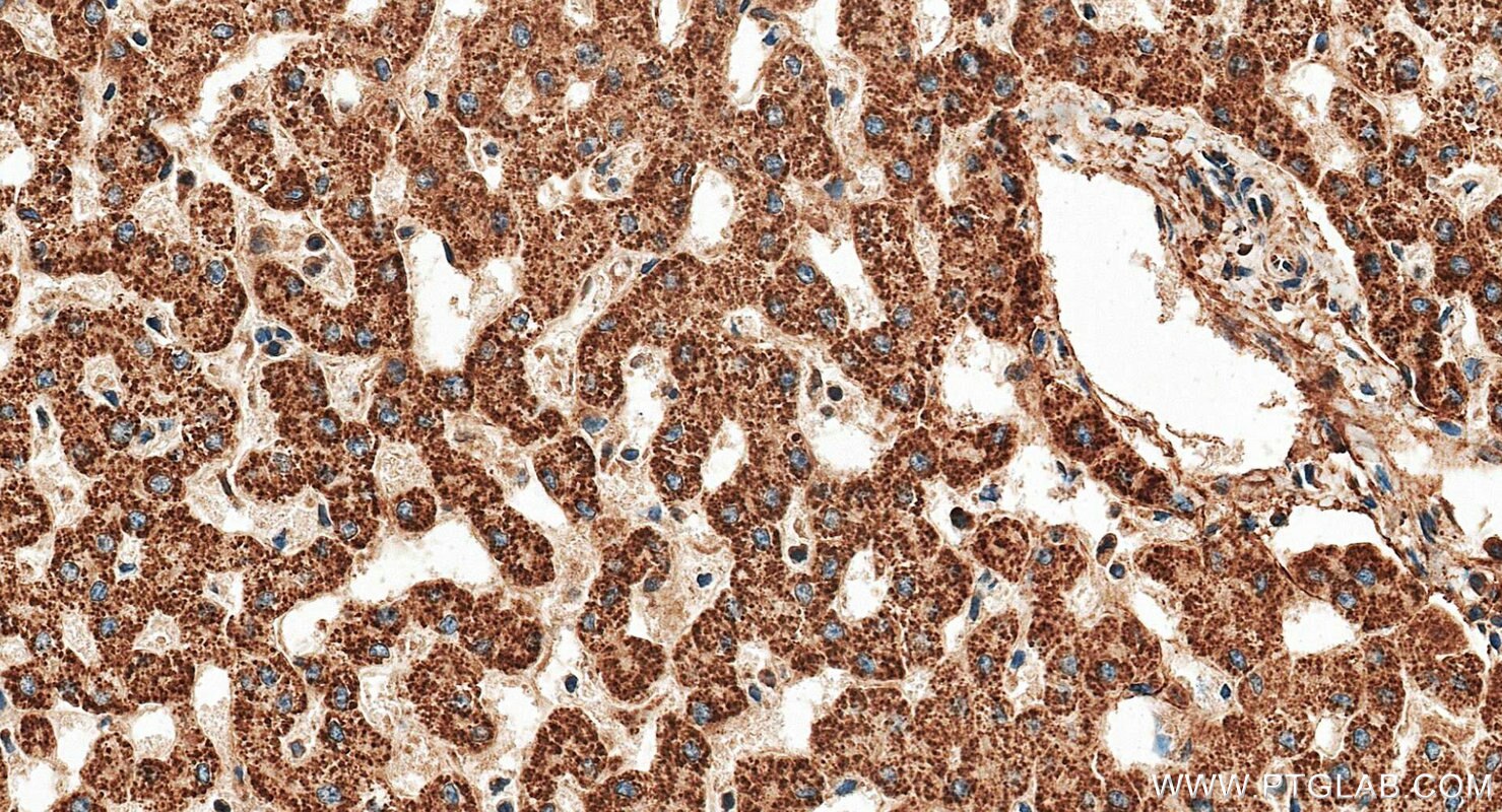 IHC staining of human liver using RMX00099 Immunohistochemistry (IHC) staining of human liver tissue using Multi-rAb® TXNRD2 Multi-Recombinant antibody (RMX00099)