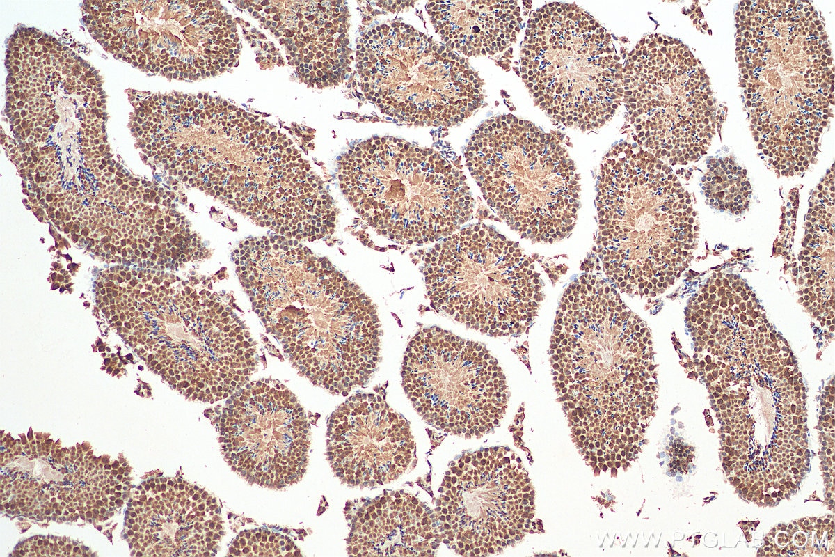 Immunohistochemistry (IHC) staining of mouse testis tissue using TXNRD3 Polyclonal antibody (19517-1-AP)